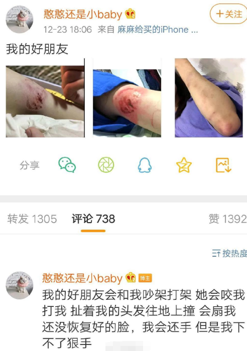 GNZ48左婧媛疑遭女友家暴手臂受伤 两人是队友 